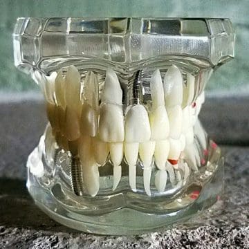 Diseased Teeth Dental Mold Curiosities Creepy Antiques