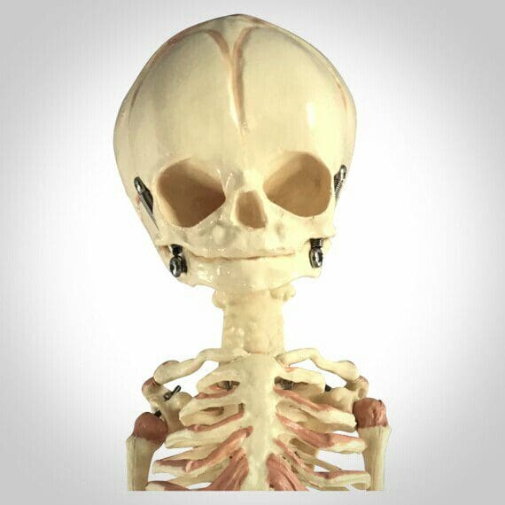 Cabinet Of Curiosities Oddities Skeleton Of Foetus Skeleton Resin 
