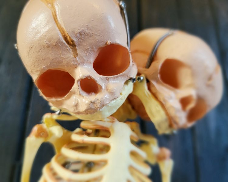2-Headed-Fetal-Skeleton, Oddities-Curiosities