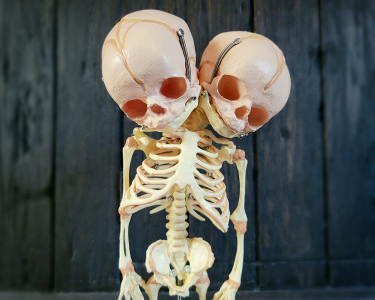 2-Headed-Fetal-Skeleton, Oddities-Curiosities