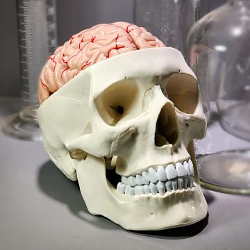 Anatomical Medical Model, Skull With Brain Model, Oddities and Curiosities, Curio, Medical Decor