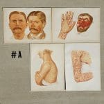 Antique Medical Plates, 1889 Atlas of Skin and Venereal Diseases, Large Medical Illustrations, Vintage Medical Prints