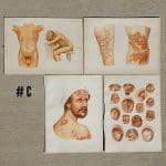 Antique Medical Plates, 1889 Atlas of Skin and Venereal Diseases, Large Medical Illustrations, Vintage Medical Prints